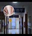 白斑光疗后变红图片对比