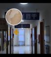 308准分子激光照4秒