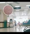 激光308治疗费用是多少