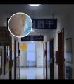 白点癫308准分子光治疗视频